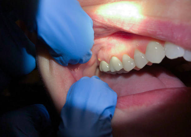 Best Emergency Dental Surgery in Catawba, SC