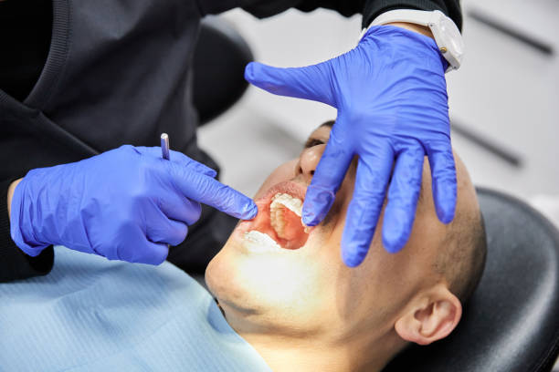 Best Emergency Dental Care for Trauma or Injury in Catawba, SC